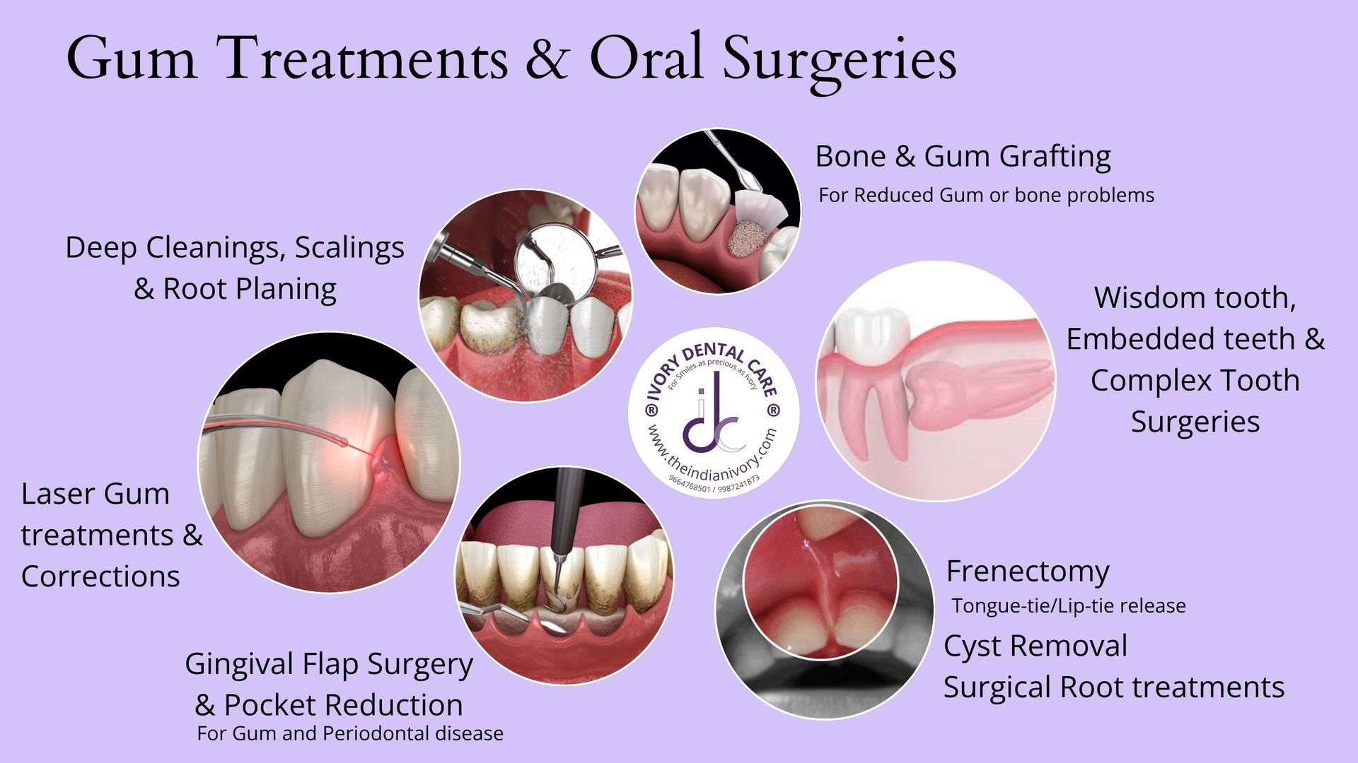 laser dentistry mumbai wisdom tooth surgery doctor in yari road