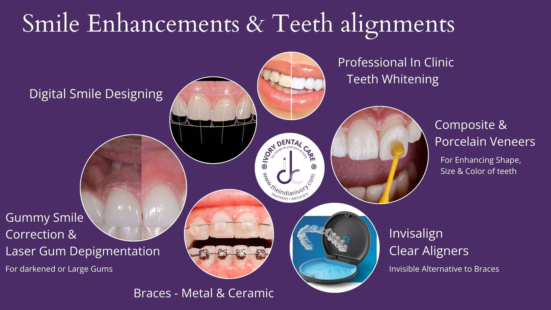 smile designing in mumbai teeth whitening in yari road best dentist in yari road